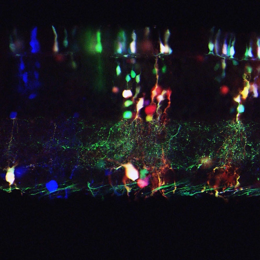 A colorful image of neurons in the brain. Kind of looks like a city at night.