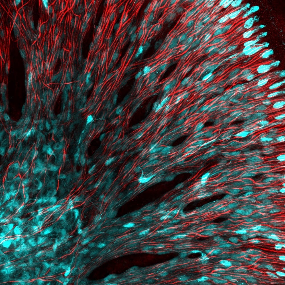 A colorful image of neurons in the brain. Kind of looks like choral.