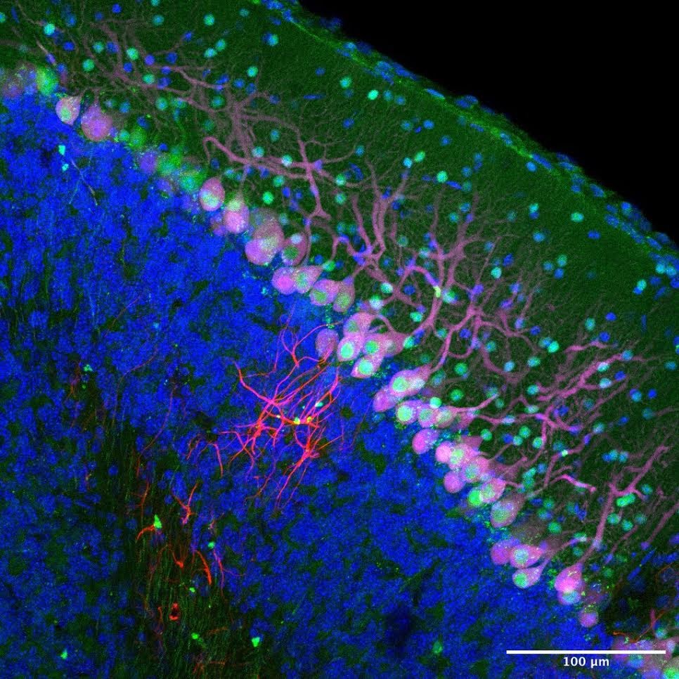 A colorful image of neurons in the brain. Kind of looks like a green hill.