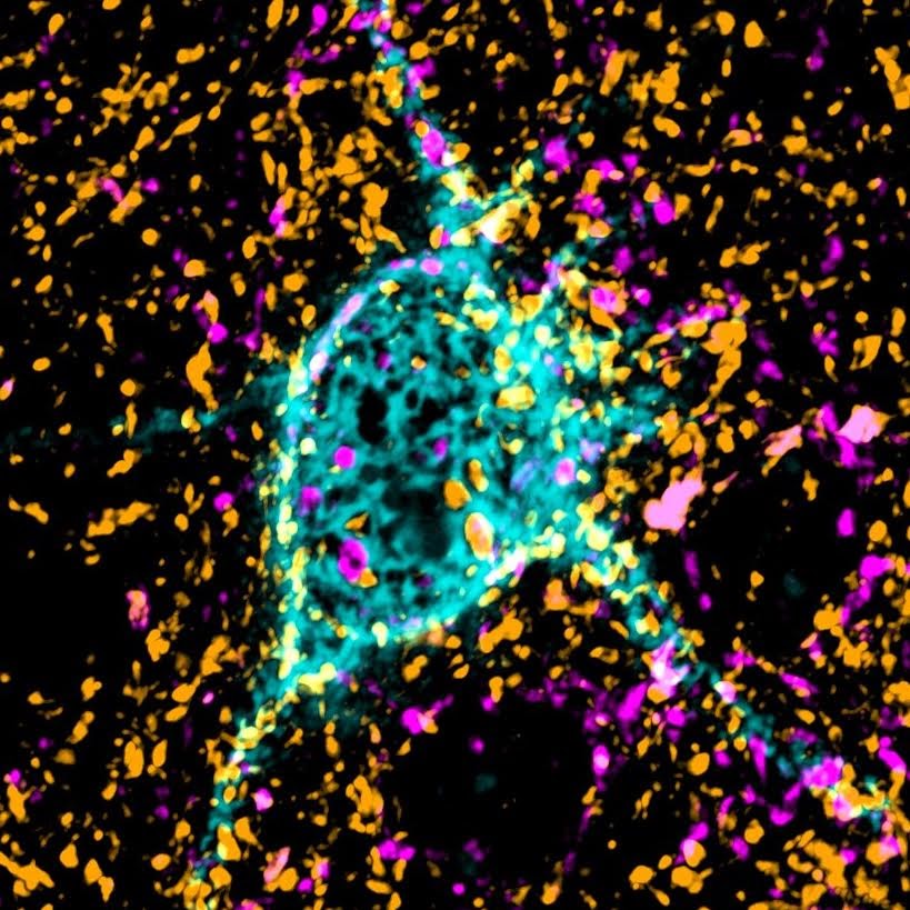 A colorful image of neurons in the brain. Kind of looks like a shark egg