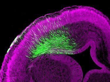 A colorful image of neurons in the brain. Kind of looks like foam.