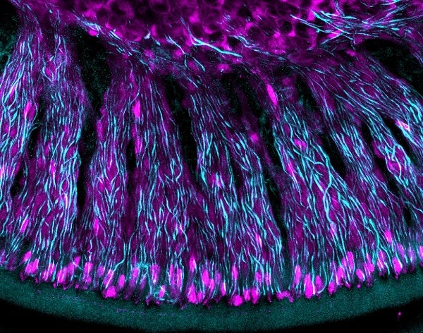 A colorful image of neurons in the brain. Kind of looks like a shag carpet.