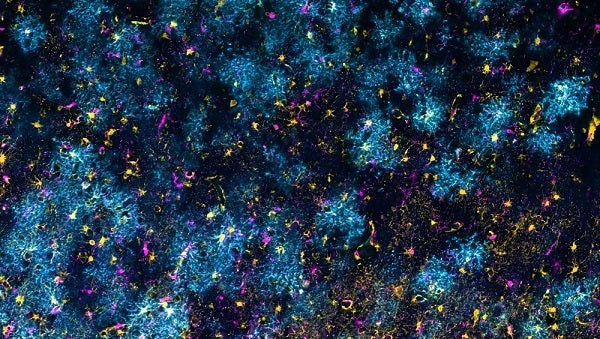 A colorful image of neurons in the brain. Kind of looks like blue trees from above.