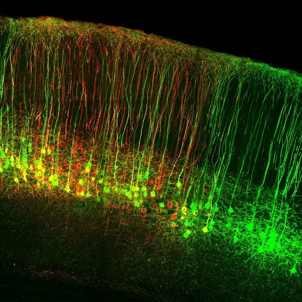 A colorful image of neurons in the brain. Kind of looks like a ton of shooting stars.