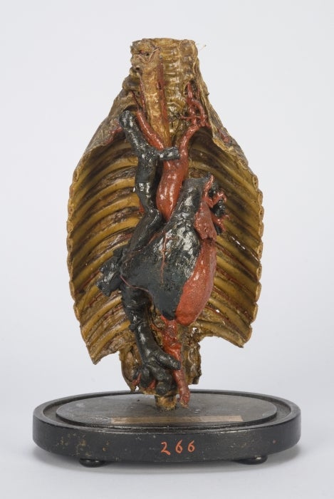 A model of a child's heart