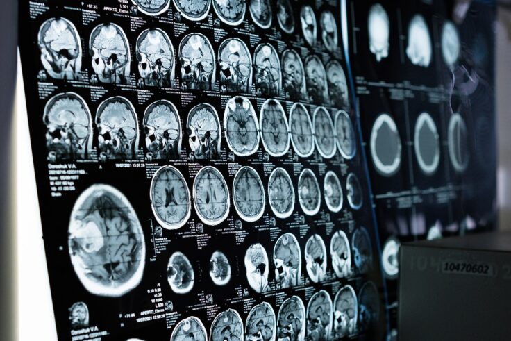 ct-scan results