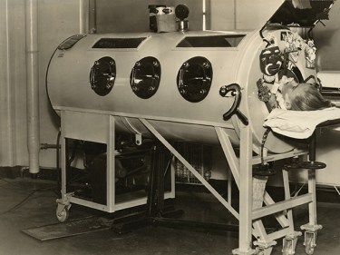 A person in an iron lung