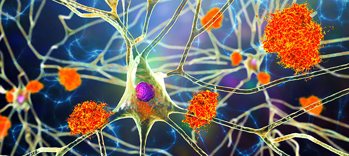 Illustration of neurons