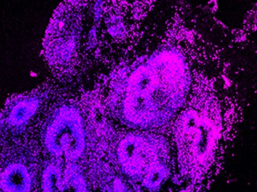 Close up of brain neurons